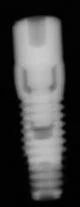 Screw Vent (3.5)